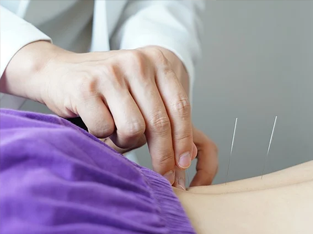 침 치료
